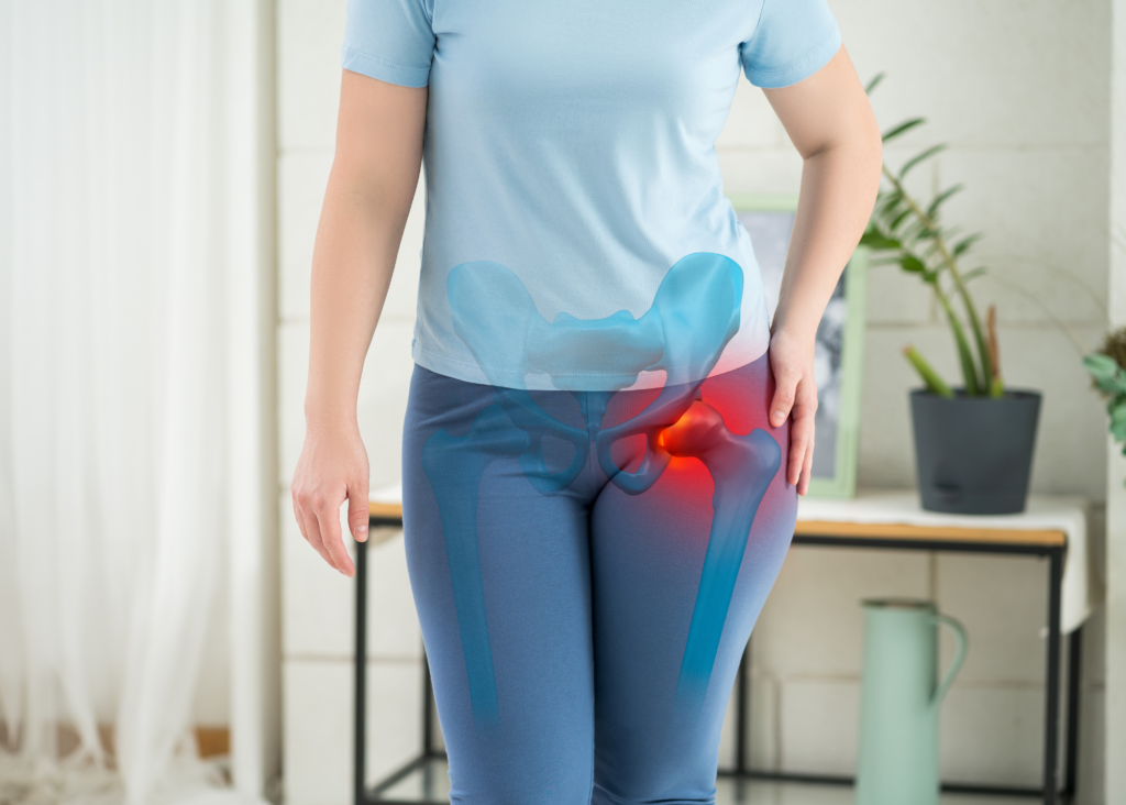 Anti-Inflammatory Diet for Osteoarthritis
